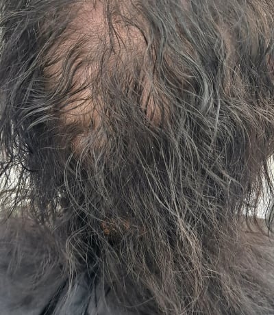 before photo of meshless topper integration with hand-tied extensions hair transformation by Monica Dillon at Hottie Hair salon Las Vegas - Hair Loss Solutions service