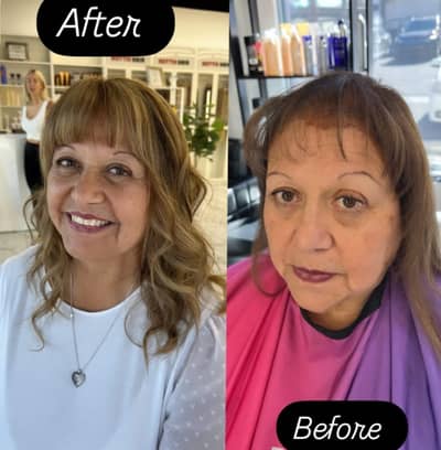 Permanent Hair Topper for Crown Thinning